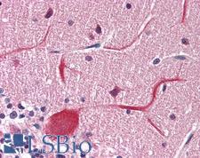 METTL14 Antibody - Human Cerebellum: Formalin-Fixed, Paraffin-Embedded (FFPE)