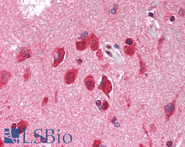 METTL14 Antibody - Human Cortex: Formalin-Fixed, Paraffin-Embedded (FFPE)