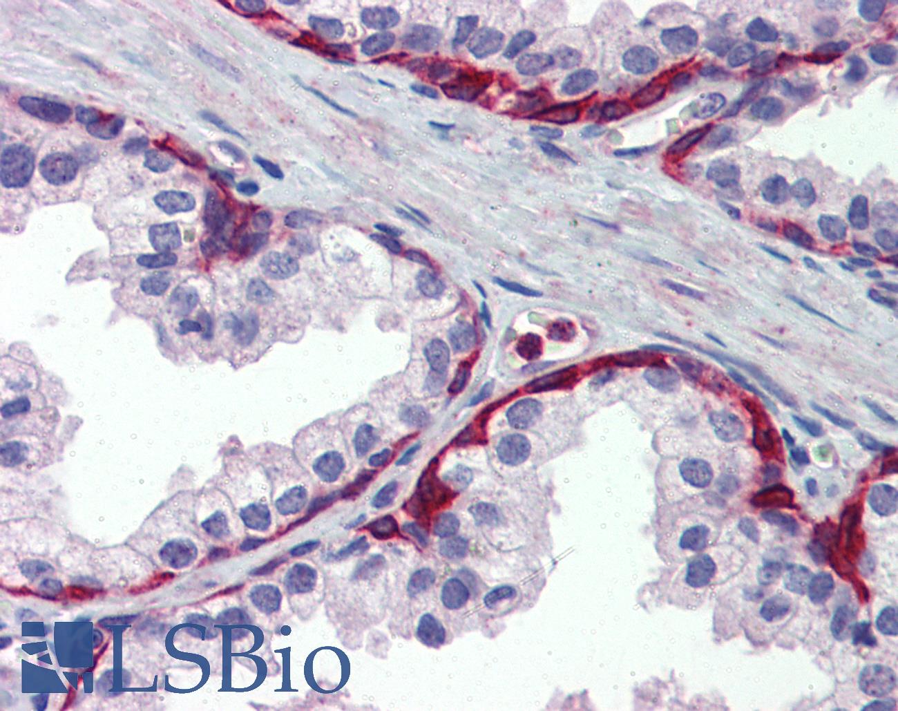 METTL7A Antibody - Anti-METTL7A antibody IHC of human prostate. Immunohistochemistry of formalin-fixed, paraffin-embedded tissue after heat-induced antigen retrieval. Antibody concentration 5 ug/ml.