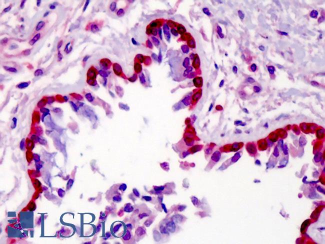 METTL7A Antibody - Anti-METTL7A antibody IHC of human lung. Immunohistochemistry of formalin-fixed, paraffin-embedded tissue after heat-induced antigen retrieval. Antibody concentration 5 ug/ml.