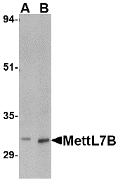 METTL7B Antibody - Western blot of MettL7B in rat spleen tissue lysate with MettL7B antibody at (A) 2 and (B) 4 ug/ml.