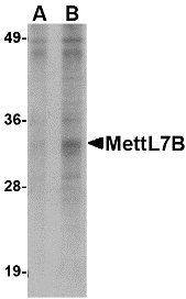 METTL7B Antibody - Western blot of MettL7B in Jurkat lysate with MettL7B antibody at (A) 2 and (B) 4 ug/ml.