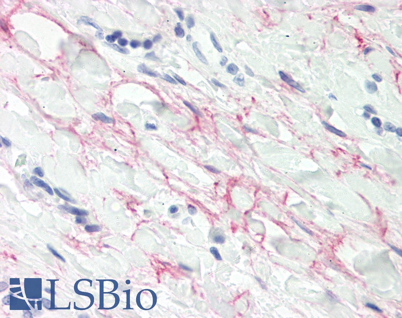 MFAP4 Antibody - Anti-MFAP4 antibody IHC staining of human tonsil, collagenous stroma. Immunohistochemistry of formalin-fixed, paraffin-embedded tissue after heat-induced antigen retrieval.