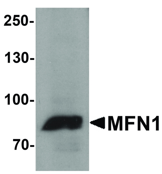 MFN1 Antibody - Western blot analysis of MFN1 in A431 cell lysate with MFN1 antibody at 1 ug/ml.