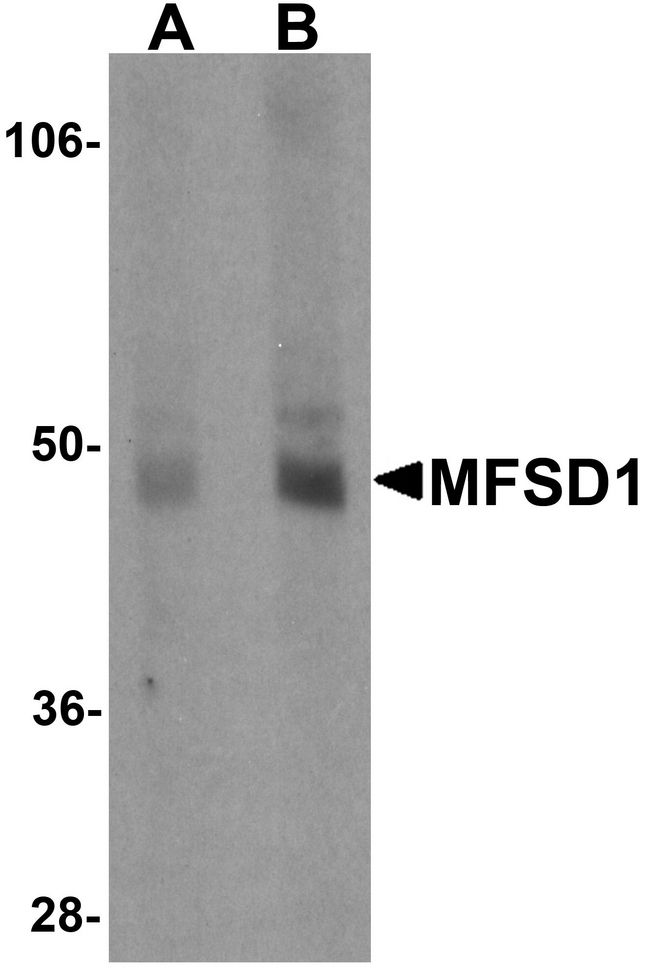 MFSD1 Antibody - Western blot analysis of MFSD1 in human lung tissue lysate with MFSD1 antibody at (A) 1 and (B) 2 ug/ml.