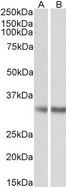 MGLL / Monoacylglycerol Lipase Antibody - MGLL / Monoacylglycerol Lipase antibody (0.5µg/ml) staining of Human Frontal Cortex (A) and Mouse Adipose (B) lysates (35µg protein in RIPA buffer). Detected by chemiluminescence.