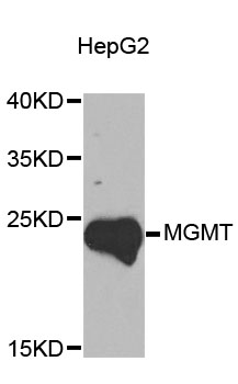 MGMT Antibody - Western blot analysis of extracts of HepG2 cells, using MGMT antibody at 1:1000 dilution. The secondary antibody used was an HRP Goat Anti-Rabbit IgG (H+L) at 1:10000 dilution. Lysates were loaded 25ug per lane and 3% nonfat dry milk in TBST was used for blocking. An ECL Kit was used for detection and the exposure time was 90s.