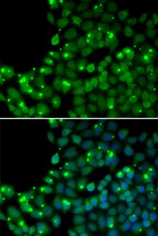MGMT Antibody - Immunofluorescence analysis of U2OS cells using MGMT antibody. Blue: DAPI for nuclear staining.