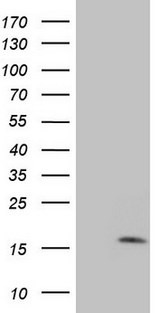 MGP / Matrix Gla-Protein Antibody - HEK293T cells were transfected with the pCMV6-ENTRY control (Left lane) or pCMV6-ENTRY MGP (Right lane) cDNA for 48 hrs and lysed. Equivalent amounts of cell lysates (5 ug per lane) were separated by SDS-PAGE and immunoblotted with anti-MGP.