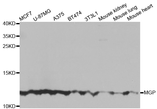 MGP / Matrix Gla-Protein Antibody - Western blot blot of extracts of various cell lines, using MGP antibody.