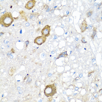 MGP / Matrix Gla-Protein Antibody - Immunohistochemistry of paraffin-embedded rat brain using MGP antibody at dilution of 1:100 (40x lens).
