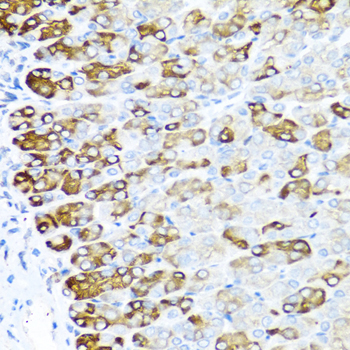 MGP / Matrix Gla-Protein Antibody - Immunohistochemistry of paraffin-embedded mouse stomach using MGP antibody at dilution of 1:100 (40x lens).