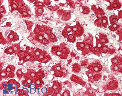 MGST1 Antibody - Human Adrenal: Formalin-Fixed, Paraffin-Embedded (FFPE)