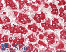 MGST1 Antibody - Human Adrenal: Formalin-Fixed, Paraffin-Embedded (FFPE)