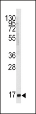 MGST1 Antibody - Western blot of anti-MGST1 antibody in K562 cell line lysates (35 ug/lane). MGST1 (arrow) was detected using the purified antibody.