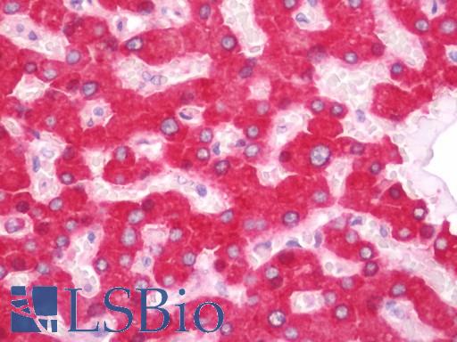 MGST1 Antibody - Anti-MGST1 antibody IHC staining of human liver. Immunohistochemistry of formalin-fixed, paraffin-embedded tissue after heat-induced antigen retrieval. Antibody dilution 1:50.