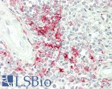 MHC Class II Antibody - Human Spleen: Formalin-Fixed, Paraffin-Embedded (FFPE)