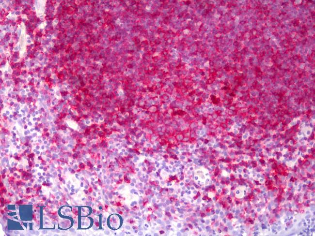 MHC Class II Antibody - Anti-MHC Class II antibody IHC of human tonsil. Immunohistochemistry of formalin-fixed, paraffin-embedded tissue after heat-induced antigen retrieval. Antibody concentration 10 ug/ml.