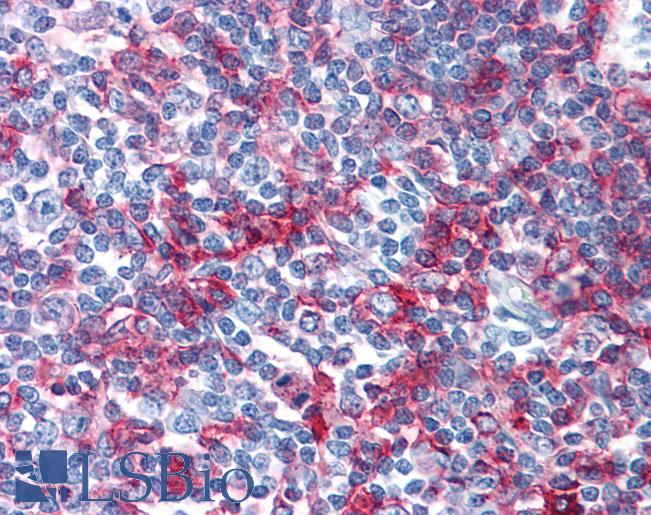 MHC Class II DQ DR Polymorphic Antibody - Anti-MHC Class II DQ DR Polymorphic antibody IHC of human tonsil. Immunohistochemistry of formalin-fixed, paraffin-embedded tissue after heat-induced antigen retrieval. Antibody dilution 1:50. This image was taken for the unconjugated form of this product. Other forms have not been tested.