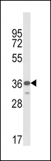 MICA Antibody - Western blot of MICA Antibody in MDA-MB231 cell line lysates (35 ug/lane). MICA (arrow) was detected using the purified antibody.