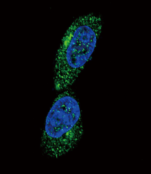 MICA Antibody - Confocal immunofluorescence of MICA Antibody with MDA-MB231 cell followed by Alexa Fluor 488-conjugated goat anti-rabbit lgG (green). DAPI was used to stain the cell nuclear (blue).