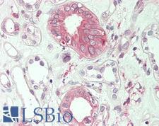 MICAL1 / MICAL Antibody - Human Kidney: Formalin-Fixed, Paraffin-Embedded (FFPE)