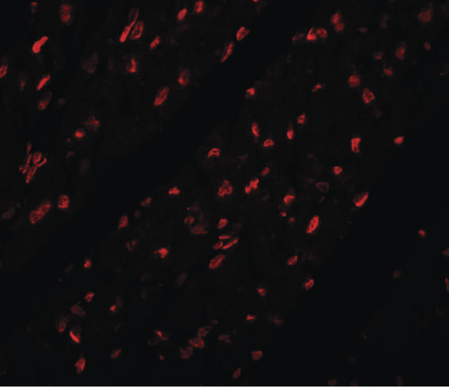 MINA / MINA53 Antibody - Immunofluorescence of MINA in mouse heart tissue with MINA antibody at 20 ug/ml.