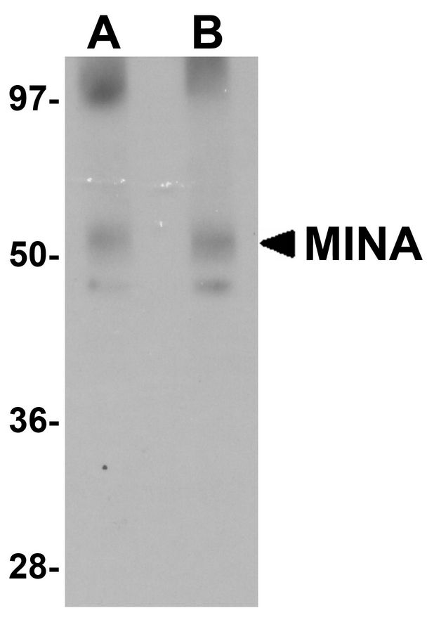 MINA / MINA53 Antibody - Western blot analysis of MINA in human heart tissue lysate with MINA antibody at (A) 1 and (B) 2 ug/ml.