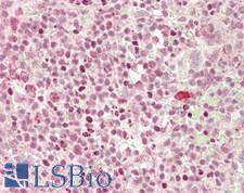 MIP2 / GRO2 / CXCL2 Antibody - Human Spleen: Formalin-Fixed, Paraffin-Embedded (FFPE)