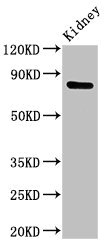 Mitofusin 2 / MFN2 Antibody - Western Blot Positive WB detected in: Rat kidney tissue All lanes: MFN2 antibody at 3µg/ml Secondary Goat polyclonal to rabbit IgG at 1/50000 dilution Predicted band size: 89, 51 kDa Observed band size: 89 kDa