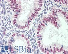 MKNK1 / MNK1 Antibody - Anti-MKNK1 / MNK1 antibody IHC staining of human uterus. Immunohistochemistry of formalin-fixed, paraffin-embedded tissue after heat-induced antigen retrieval. Antibody dilution 1:200.