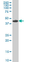 MKNK1 / MNK1 Antibody - MNK1 monoclonal antibody, clone 2F12. Western blot of MNK1 expression in Raw 264.7. (Isoform: 51.342, 47.402, 39.103 kD).