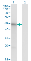 MKNK1 / MNK1 Antibody - Western blot of MKNK1 expression in transfected 293T cell line by MKNK1 monoclonal antibody, clone 2H8.