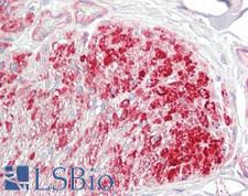 MLC2 / MYL9 Antibody - Human Small Intestine, Smooth Muscle: Formalin-Fixed, Paraffin-Embedded (FFPE)