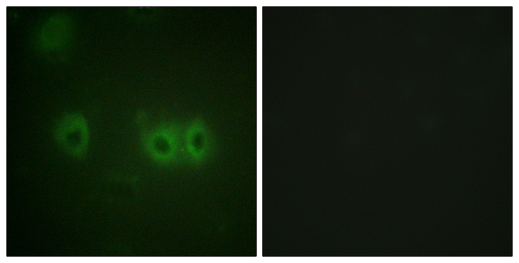 MLC2 / MYL9 Antibody - Immunofluorescence analysis of HUVEC cells, using MRLC2 Antibody. The picture on the right is blocked with the synthesized peptide.