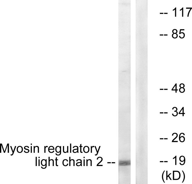 MLC2 / MYL9 Antibody - Western blot analysis of lysates from COLO205 cells, using MRLC2 Antibody. The lane on the right is blocked with the synthesized peptide.