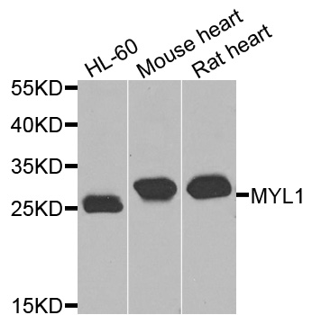 MLC3F / MYL1 Antibody - Western blot blot of extracts of various cells, using MYL1 antibody.