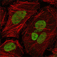 MLH1 Antibody - Confocal immunofluorescence of HeLa cells using MLH1 mouse monoclonal antibody (green), showing nuclear localization. Red: Actin filaments have been labeled with Alexa Fluor-555 phalloidin.