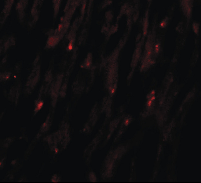 MLIP Antibody - Immunofluorescence of MLIP in human heart tissue with MLIP antibody at 20 ug/ml.