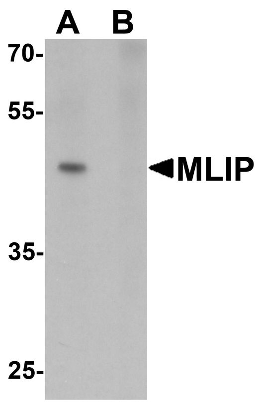 MLIP Antibody - Western blot analysis of MLIP in 293 cell lysate with MLIP antibody at 1 ug/ml in (A) the absence and (B) the presence of blocking peptide.