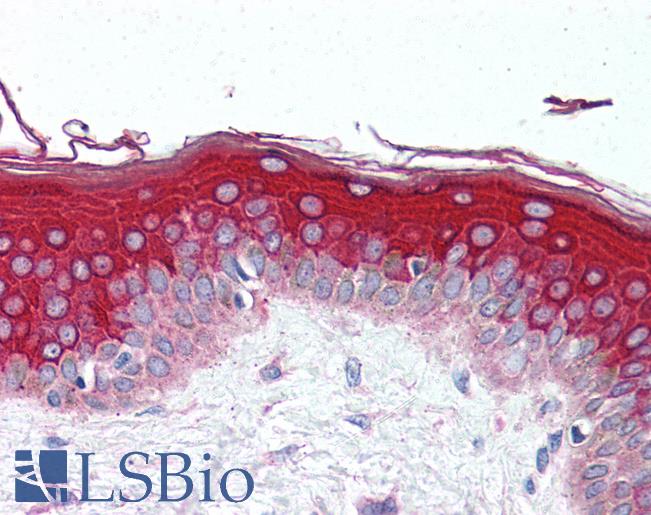 MLST8 / GBL Antibody - Anti-GBL antibody IHC of human skin. Immunohistochemistry of formalin-fixed, paraffin-embedded tissue after heat-induced antigen retrieval. Antibody concentration 10 ug/ml.