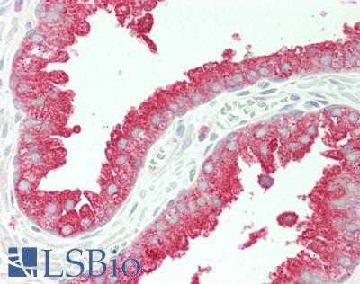 MLST8 / GBL Antibody - Human Prostate: Formalin-Fixed, Paraffin-Embedded (FFPE)