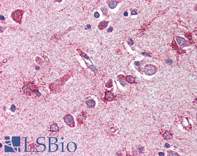 MLST8 / GBL Antibody - Anti-GBL antibody IHC of human brain, cortex. Immunohistochemistry of formalin-fixed, paraffin-embedded tissue after heat-induced antigen retrieval. Antibody concentration 5 ug/ml.