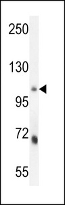 MLXIP / MONDOA Antibody - MLXIP Antibody western blot of mouse lung tissue lysates (35 ug/lane). The MLXIP antibody detected the MLXIP protein (arrow).