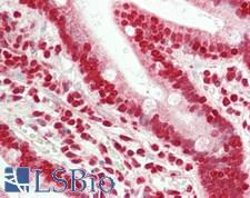 MLXIP / MONDOA Antibody - Human Small Intestine: Formalin-Fixed, Paraffin-Embedded (FFPE)
