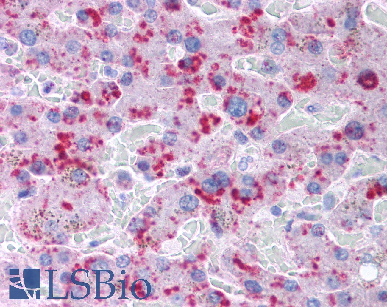 MLXIPL / CHREBP Antibody - Anti-MLXIPL / CHREBP antibody IHC of human liver. Immunohistochemistry of formalin-fixed, paraffin-embedded tissue after heat-induced antigen retrieval. Antibody concentration 5 ug/ml.  This image was taken for the unconjugated form of this product. Other forms have not been tested.