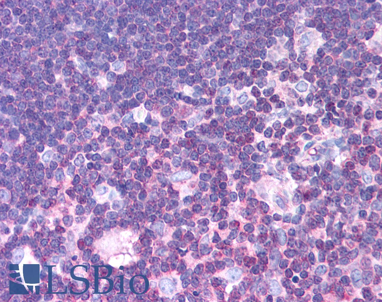 MLXIPL / CHREBP Antibody - Anti-MLXIPL / CHREBP antibody IHC of human thymus. Immunohistochemistry of formalin-fixed, paraffin-embedded tissue after heat-induced antigen retrieval. Antibody concentration 5 ug/ml.  This image was taken for the unconjugated form of this product. Other forms have not been tested.
