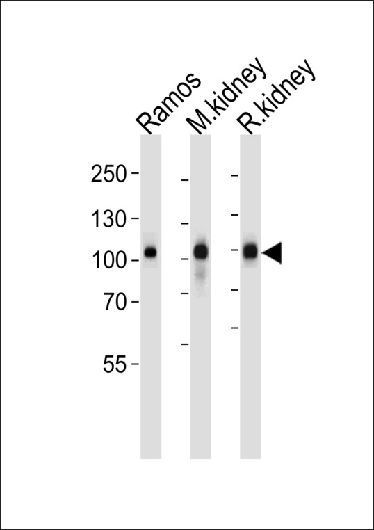 MME / CD10 Antibody - Western blot of lysates from Ramos cell line,mouse kidney and rat kidney tissue (from left to right),using Neprilysin Antibody. Antibody was diluted at 1:1000 at each lane. A goat anti-rabbit IgG H&L (HRP) at 1:5000 dilution was used as the secondary antibody.Lysates at 35ug per lane.