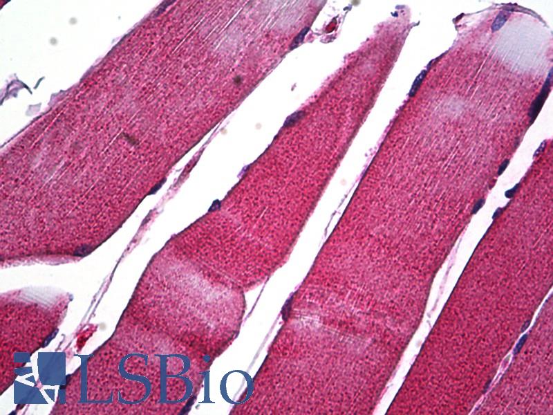 MMP1 Antibody - Anti-MMP1 antibody IHC of human skeletal muscle. Immunohistochemistry of formalin-fixed, paraffin-embedded tissue after heat-induced antigen retrieval. Antibody dilution 1:50.