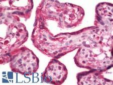 MMP1 Antibody - Human Placenta: Formalin-Fixed, Paraffin-Embedded (FFPE)